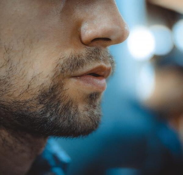 Patchy Beard Problem | Causes & Solutions of Patchy Beard