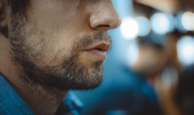 Patchy Beard Problem | Causes & Solutions of Patchy Beard