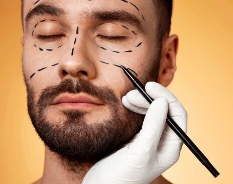 All About Beard Transplant | Procedure, Cost, Side Effects